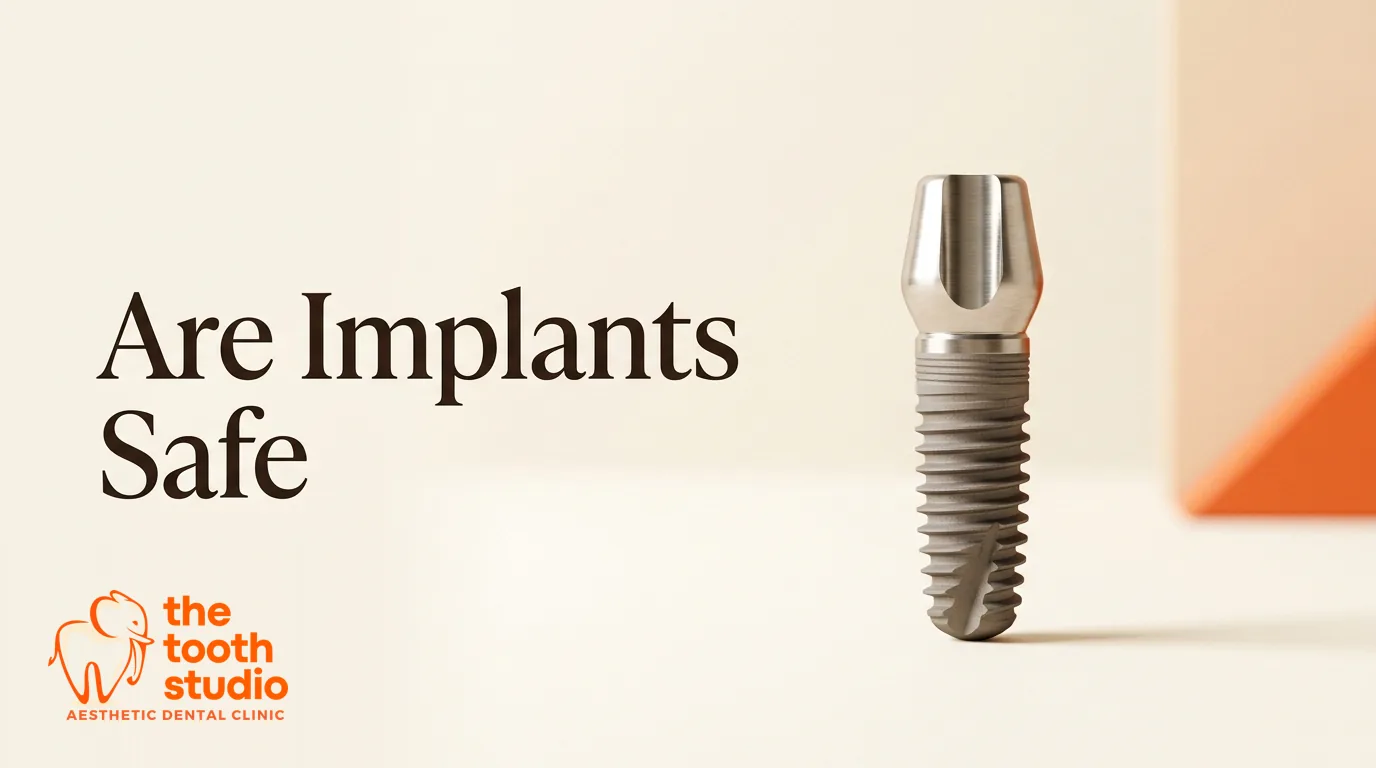 Are Dental Implants Safe? Success Rate and Risks - The Tooth Studio, Kukatpally Hyderabad