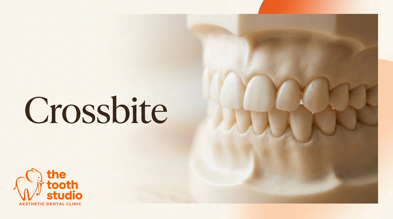Crossbite: Causes and Treatment Options - The Tooth Studio, Kukatpally Hyderabad