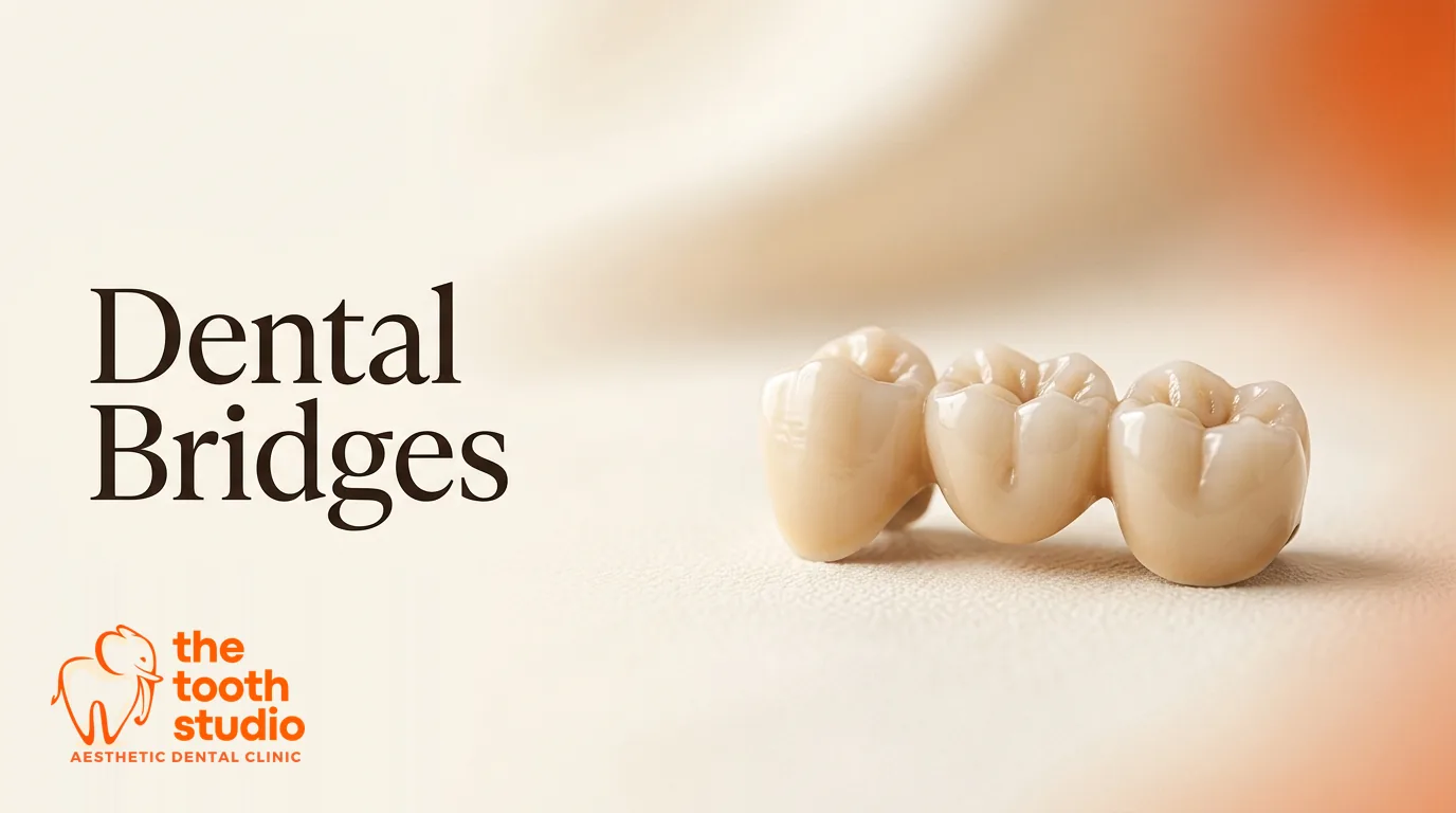 Dental Bridges: Types, Cost and How Long They Last - The Tooth Studio, Kukatpally Hyderabad