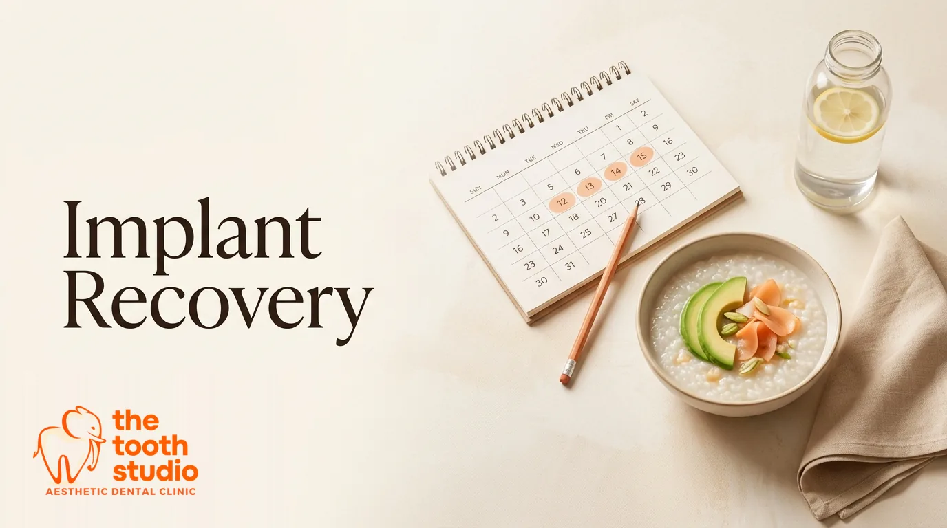 Dental Implant Recovery: A Week-by-Week Aftercare Guide - The Tooth Studio, Kukatpally Hyderabad
