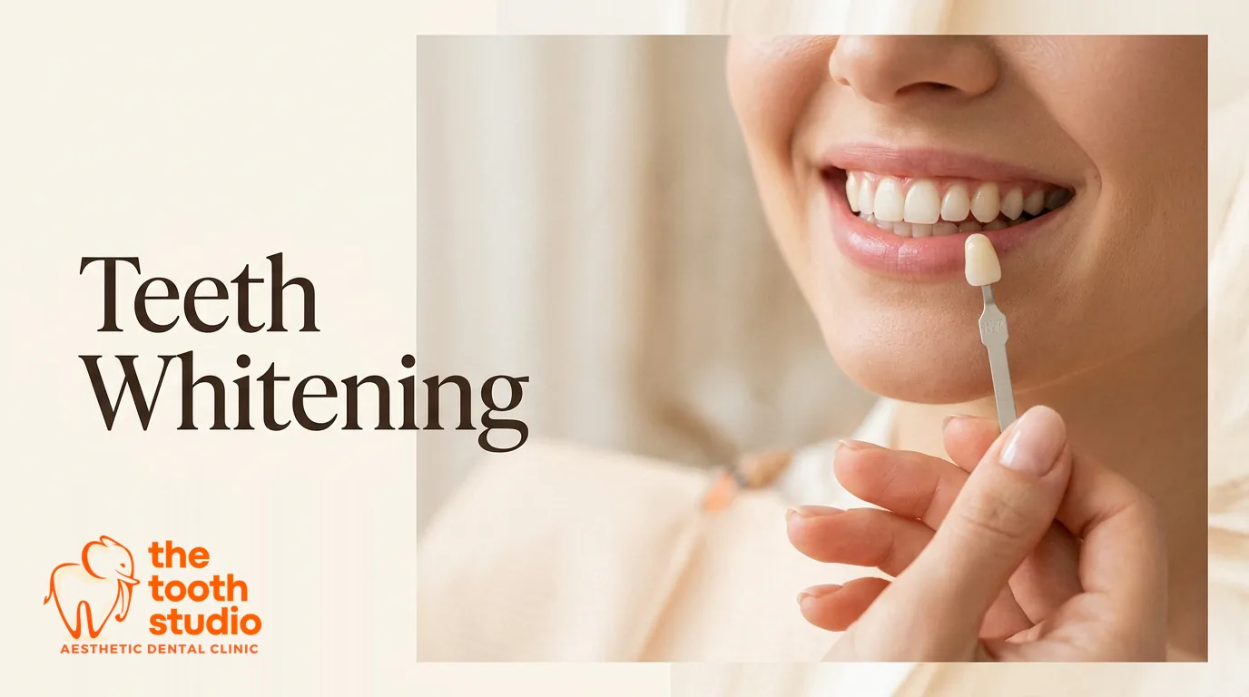 Teeth Whitening: Is It Safe and How Long Does It Last? - The Tooth Studio, Kukatpally Hyderabad
