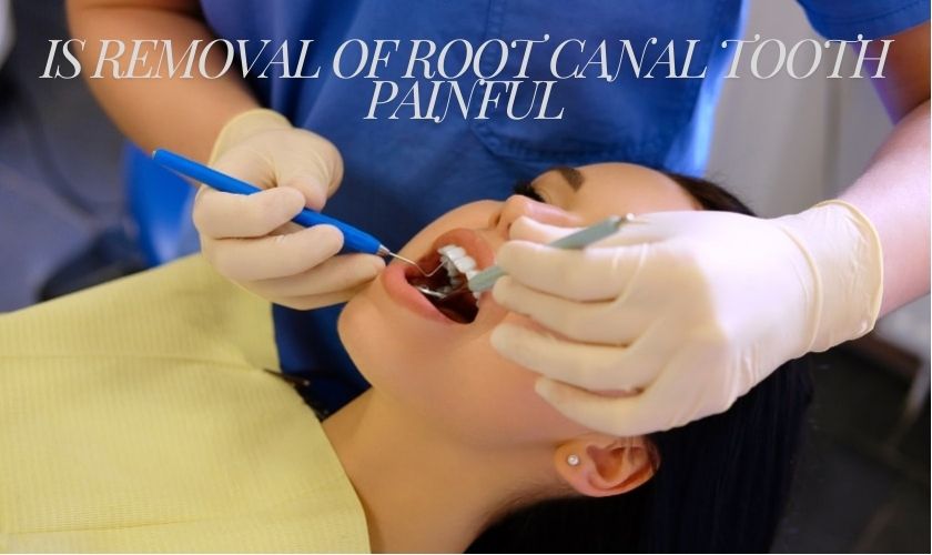 root canal tooth