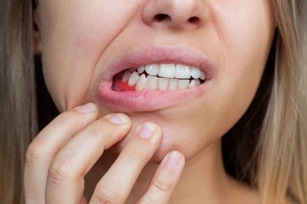 Gum Problems - Common Dental Problems