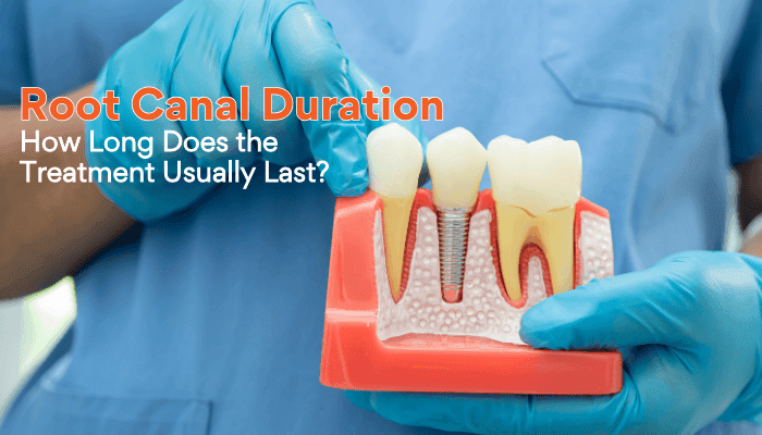 Root canal duration