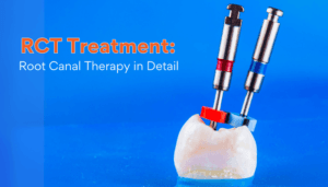 RCT Treatment