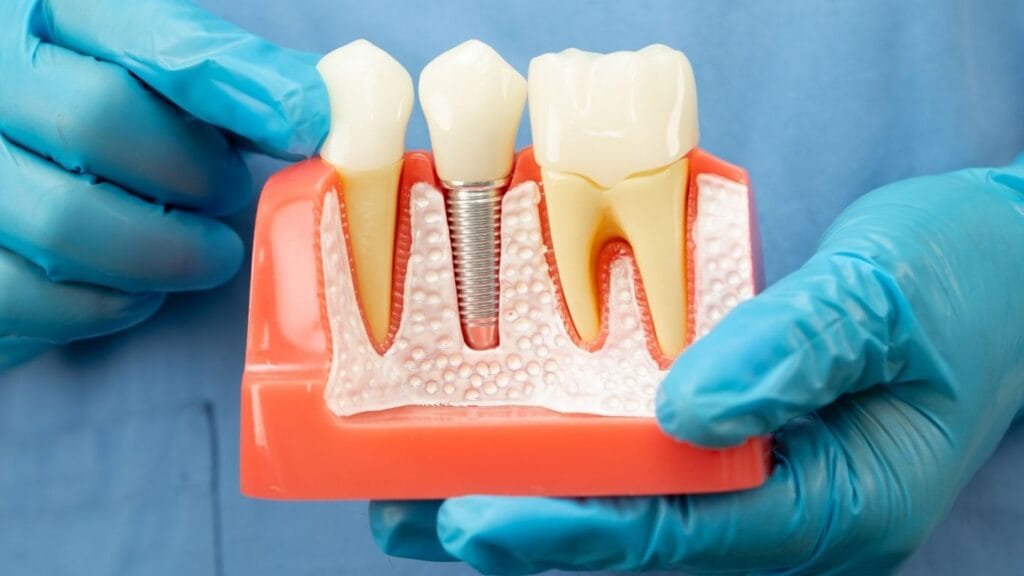 Common Dental Problems